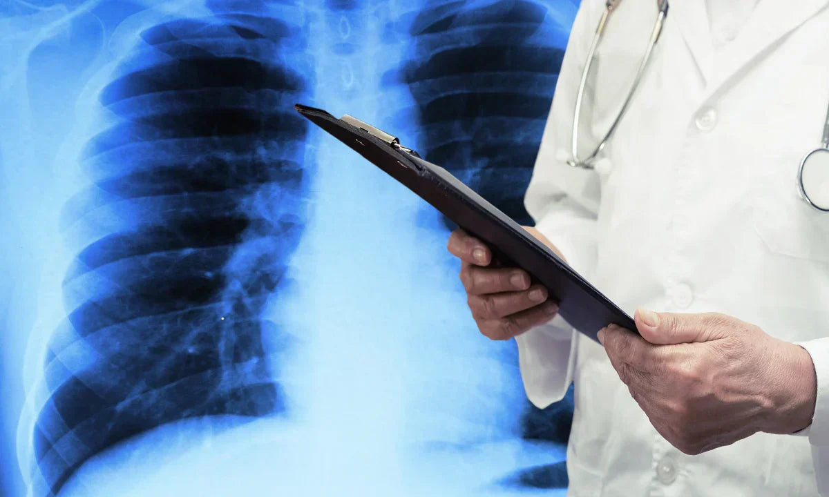  Pneumothorax